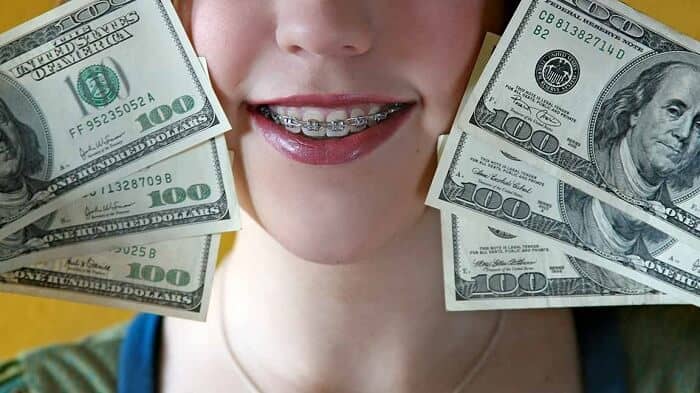 how to save money on braces